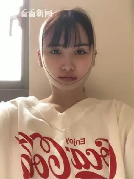 女子被父親怒批長相帶來不幸! 整容5年成日本網紅