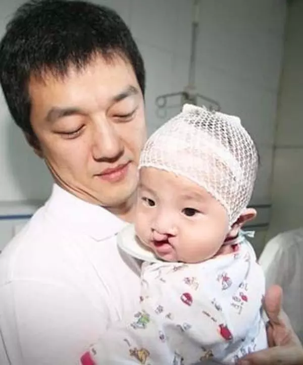 王菲的「唇顎裂女兒」11歲了!自信破表、漂亮樣貌,真的完全不輸當年的王菲!