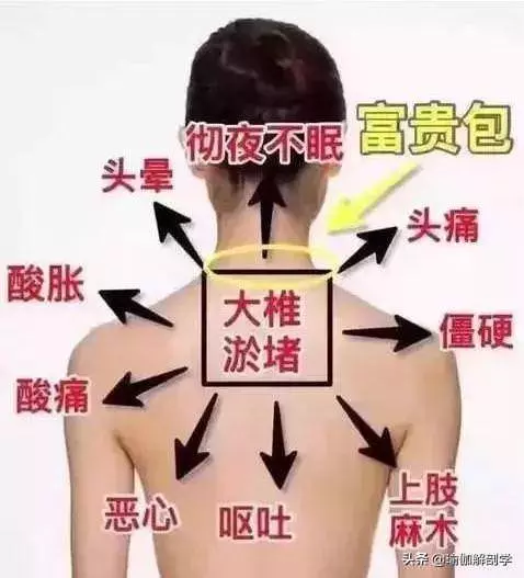 脖子粗背厚,越來越胖?這是經絡不通,用陰瑜伽這樣來拉伸...!