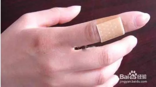 婦人打掃完家裡「8根指頭焦黑」慘變枯枝!連醫生也搖頭嘆:她太粗心了