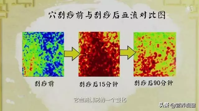 手到病除二:治頸椎病