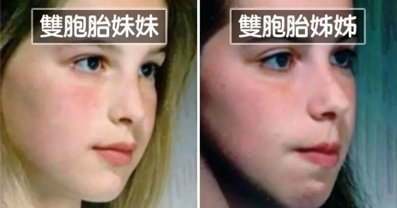 習慣嘴巴開開呼吸?醫學研究「舌頭擺放位置」決定未來顏值!~~~