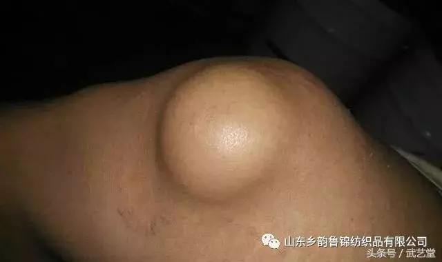 膝蓋疼、膝蓋響,一把香菜加生薑,膝蓋再也不疼了