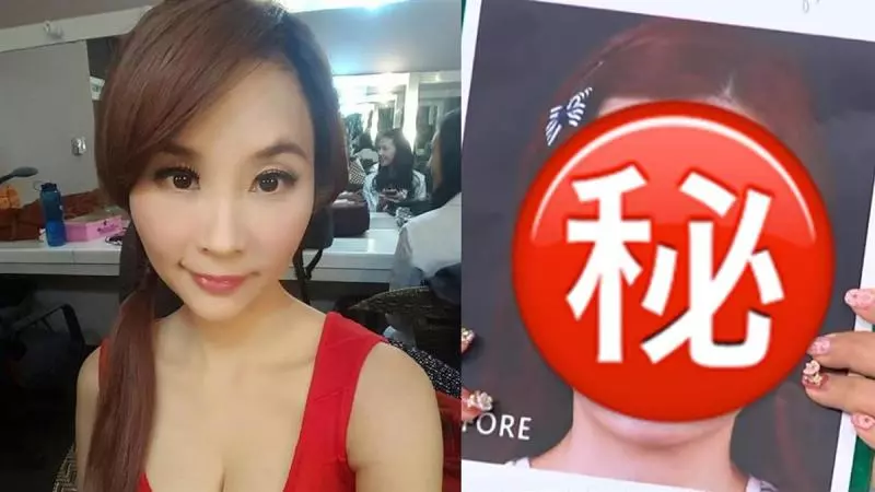 許聖梅爆整型臉毀了! 崩潰下一病人慘死手術台