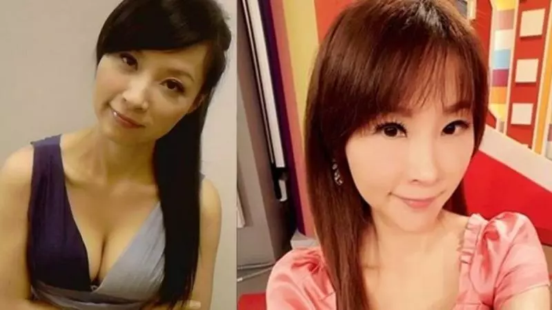 許聖梅爆整型臉毀了! 崩潰下一病人慘死手術台