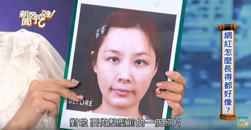 許聖梅爆整型臉毀了! 崩潰下一病人慘死手術台