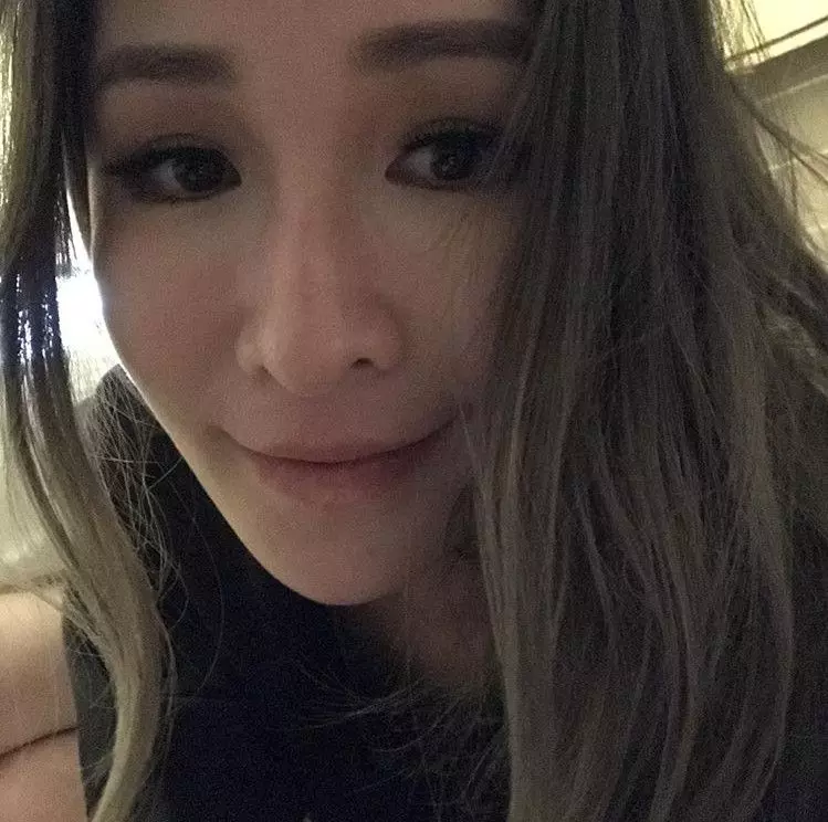 蕭亞軒被爆染怪病!神隱1年亮相 近況曝光