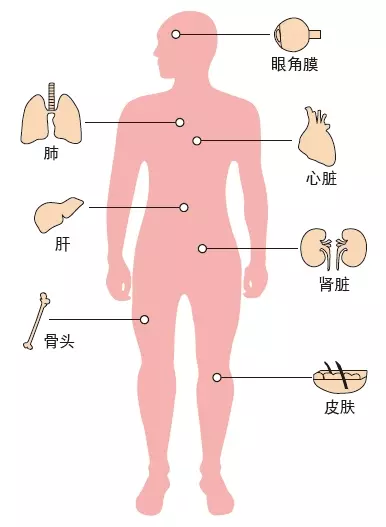 「如果我死了, 會有人比我更需要我的器官……」⁉ 3個大馬人一定"不可以"簽捐贈器官卡的理由