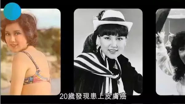 2度拿金像獎女配角,不怕被說整容怪,住千萬別墅過隱形富婆生活!