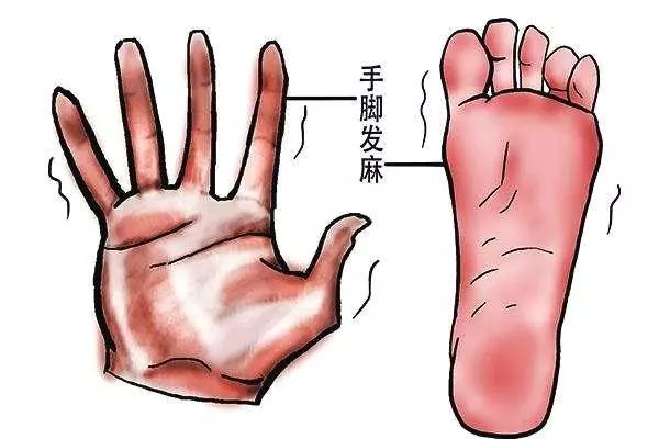 忽冷忽熱引起手腳酸麻!按按手指暢通氣血不抽筋