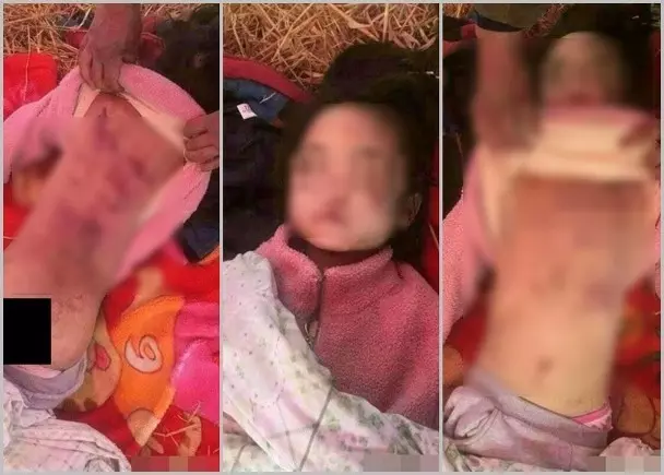 7歲女童被長期受虐!為躲狠母摔下樓梯慘死