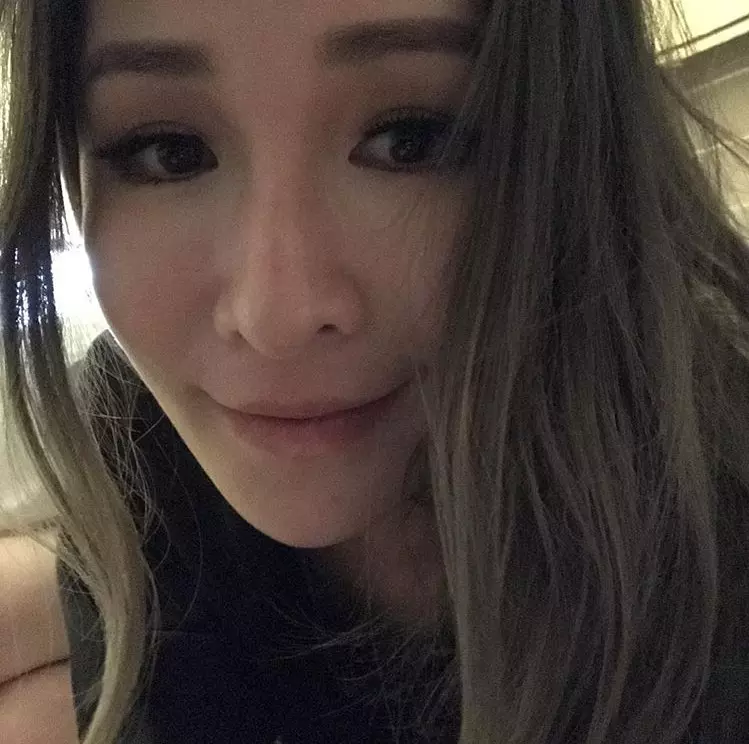 蕭亞軒被爆染怪病!神隱1年亮相, 近況曝光,網友尖叫:竟是這般模樣!
