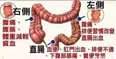身體健康的人一天排便幾次才算正常,不論男女每天能在固定的時間排便,恭喜 ,腸道很健康