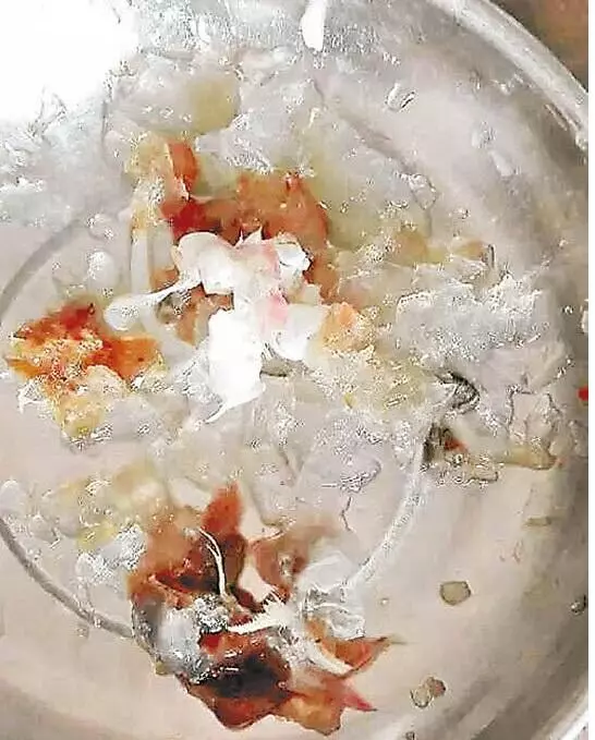 她從市場買回一袋蝦子,回家後發現蝦頭實在巨大的太詭異了!剝開蝦頭一看,裡面竟然是『這個東西』!愛吃蝦的人真的要注意了!