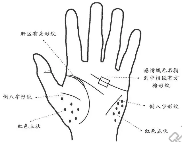 頭痛、頭眩、雙腿沉、腰痛等不能確症,通過掌紋知道原因輕鬆痊癒