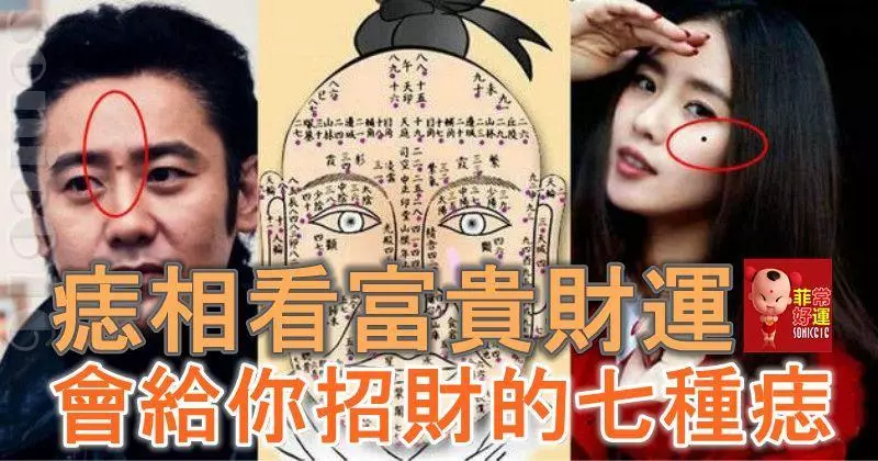 痣相看富貴財運:會給你招財的七種痣,要錢有錢,好運相伴,你有嗎?