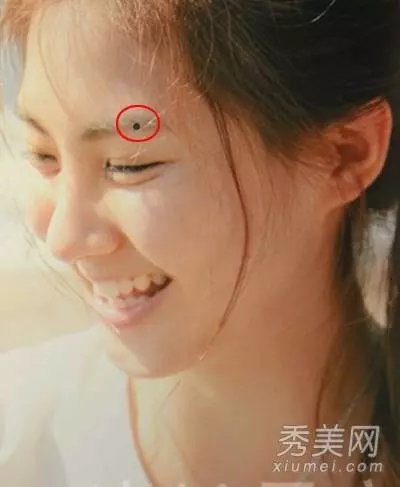 痣相看富貴財運:會給你招財的七種痣,要錢有錢,好運相伴,你有嗎?