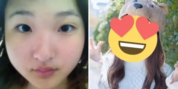 「你的樣子會為他人帶來不幸」 老爸一句話讓日本少女花400萬整形