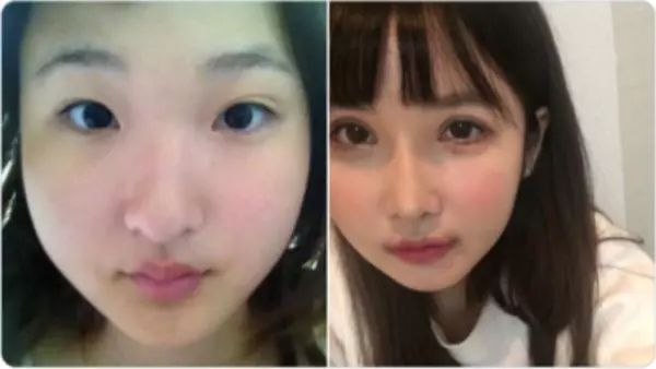 「你的樣子會為他人帶來不幸」 老爸一句話讓日本少女花400萬整形