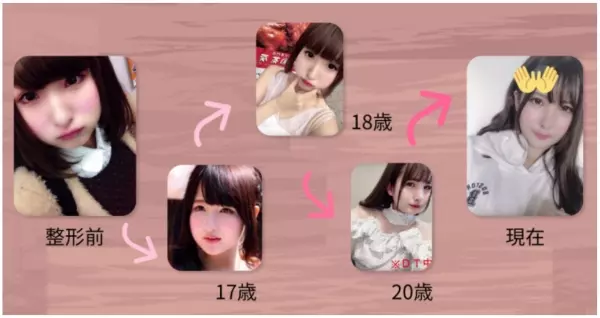 「你的樣子會為他人帶來不幸」 老爸一句話讓日本少女花400萬整形