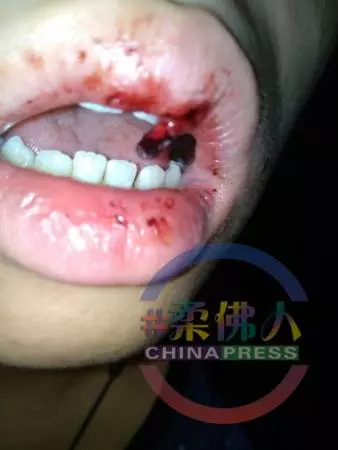 【專題】遭嗜賭父水管鞭打 倒吊窗口 少女性格扭曲變雙面人