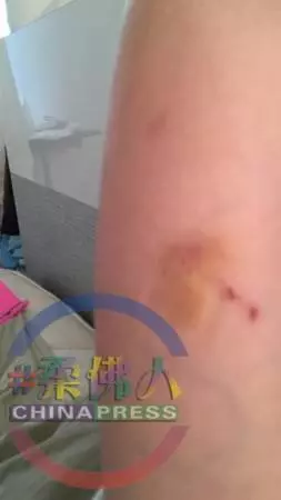 【專題】遭嗜賭父水管鞭打 倒吊窗口 少女性格扭曲變雙面人