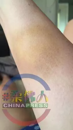 【專題】遭嗜賭父水管鞭打 倒吊窗口 少女性格扭曲變雙面人