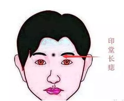 八個窮人痣,親人不親,家宅不和,一輩子奔波勞碌命!
