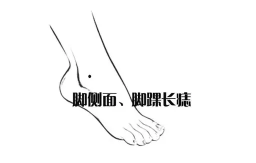 八個窮人痣,親人不親,家宅不和,一輩子奔波勞碌命!