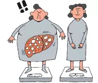 脂肪肝,膳食營養要從這五方面調整