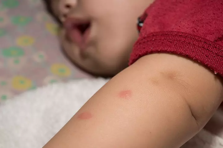 蚊子也會欺善怕惡!研究發現「越善良」越容易被蚊子叮 牠們光看「你的動作」就知道