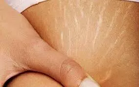 女生不知道太虧! 13種「小蘇打粉居家妙用」難怪大家都在囤~