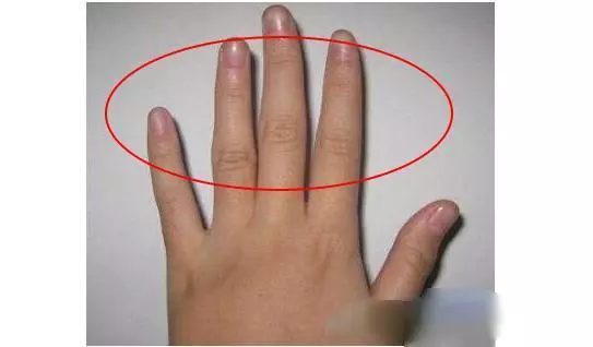 教你通過看手指知道——自己一生會有幾段婚姻