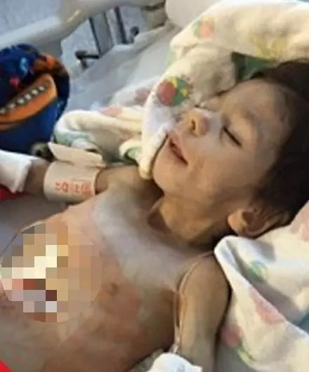 7歲男童瘦到只剩3公斤,被善心夫妻收養,1年後變得像天使一樣美!