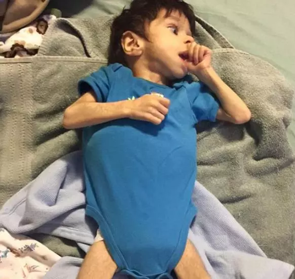 7歲男童瘦到只剩3公斤,被善心夫妻收養,1年後變得像天使一樣美!