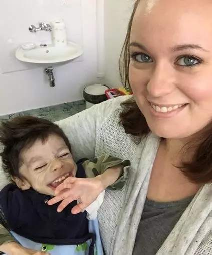 7歲男童瘦到只剩3公斤,被善心夫妻收養,1年後變得像天使一樣美!