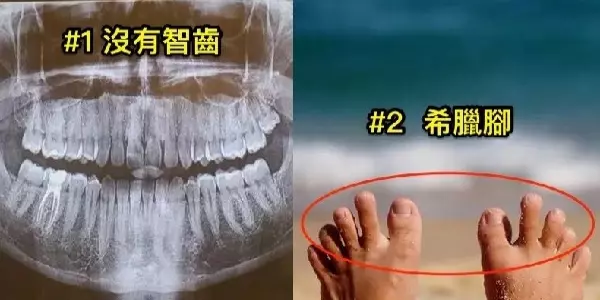 12種「被神特別眷顧」才擁有的超罕見身體特徵!#12 「這種心臟」根本百年難得一見!