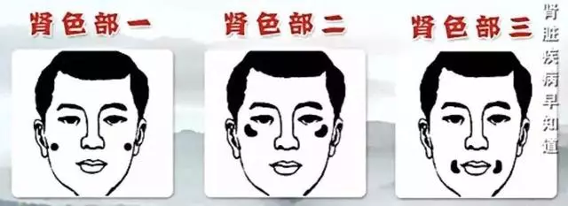 老中醫教你從臉色看自身疾病,多注意