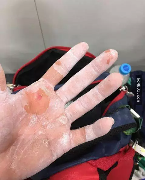 會讓你打從心底佩服體操選手們的16張照片!第12張太誇張了吧!看到都怕...~~~