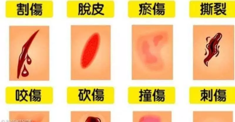 下面就是9個大多數人都誤會了的急救方式,這樣做沒辦法救人,反而會讓情況更糟糕。~~~~~
