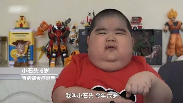 6歲小胖弟「不上學開直播」被罵斂財 爸媽曝心酸原因 ,百萬網友淚崩:太勇敢了!