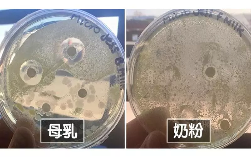 原來母乳那麼強 生物系媽媽比較母乳和奶粉生菌速度「1天少一半」...大讚:胸部好神奇