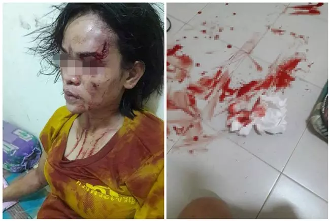 孕婦剛生完小孩 隨即被丈夫暴打
