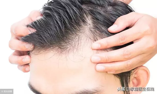頭髮一天不洗就很油?改掉6件事,還你清爽頭髮!