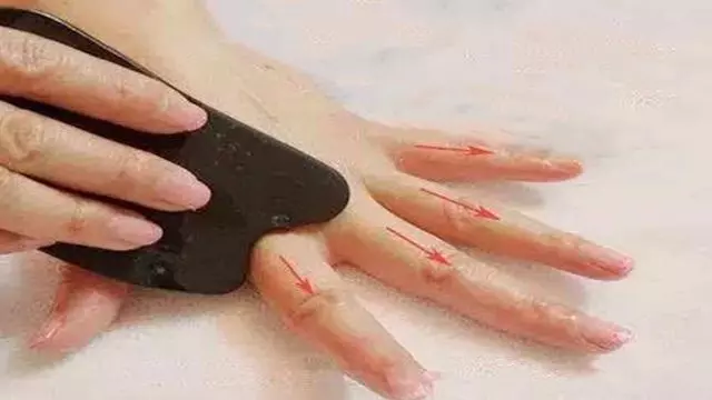 【刮手指,可調百病!】