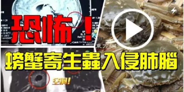 小心,避免這樣吃螃蟹! 中國男童生吃螃蟹,吞下寄生蟲入侵肺腦!