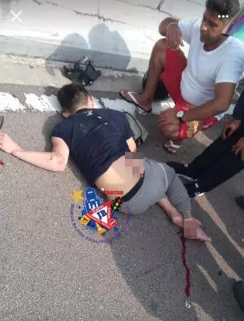 關卡摩哆專用道車禍 司機誤闖 撞傷騎士