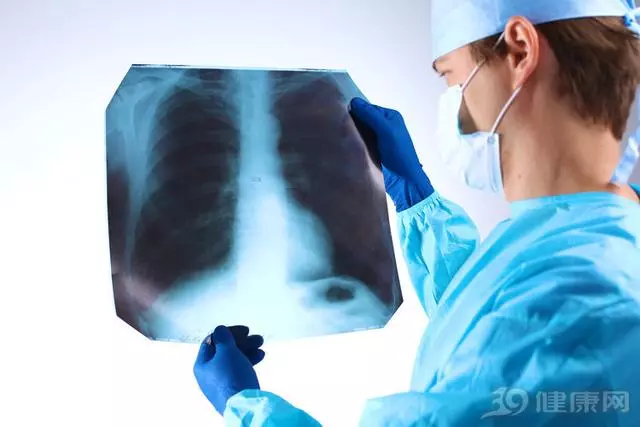 肺不好的人都曾後悔:這4件傷肺事,早點遠離就好了