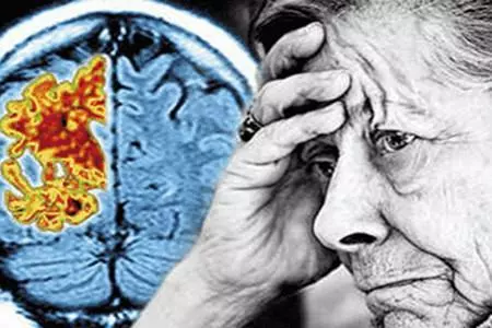 怎麼改善大腦健康?這種活動每天一小時,延緩大腦衰老1.1年。