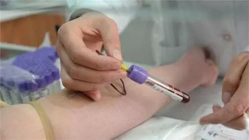 情侶好玩驗DNA!結果女友見男友「驚人血脈」…嚇到分手